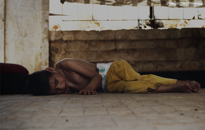 시리아 시리아내전 알레포 알레포어린이 어린이 영양실조 폭탄 전쟁 폭격 유니세프 난민